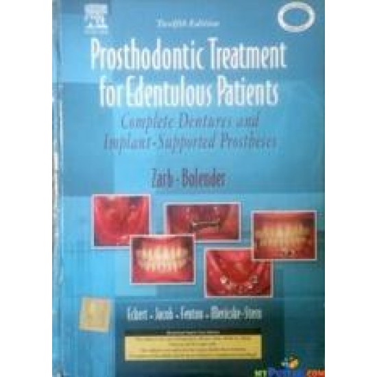 Dental Prosthodontic Treatment For Edentulous Patients 12th Edition By ZARB BOLENDER