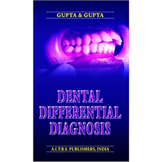 Dental Differential Diagnosis by Gupta and Gupta