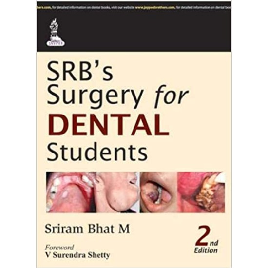 Srb'S Surgery For Dental Students 2nd Edition by Bhat M Sriram