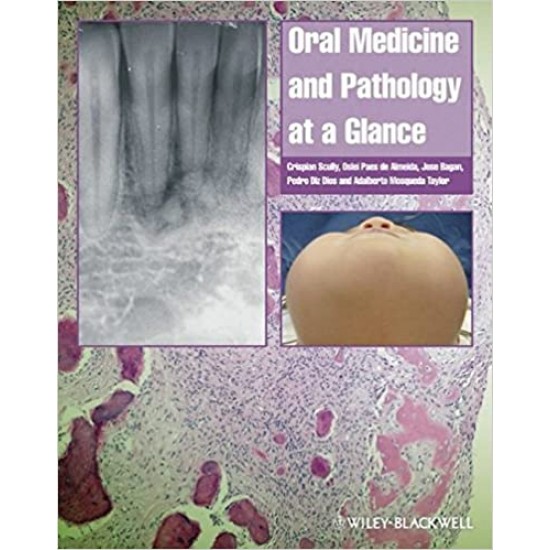 Oral Medicine and Pathology at a Glance 1st Edition by Crispian Scully