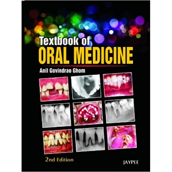 Textbook of Oral Medicine, 2nd Edition by Anil Govindrao Ghom