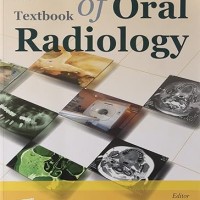 Textbook of Oral Radiology by Anil Govindrao Ghom Textbook of Oral Radiology by Anil Govindrao Ghom