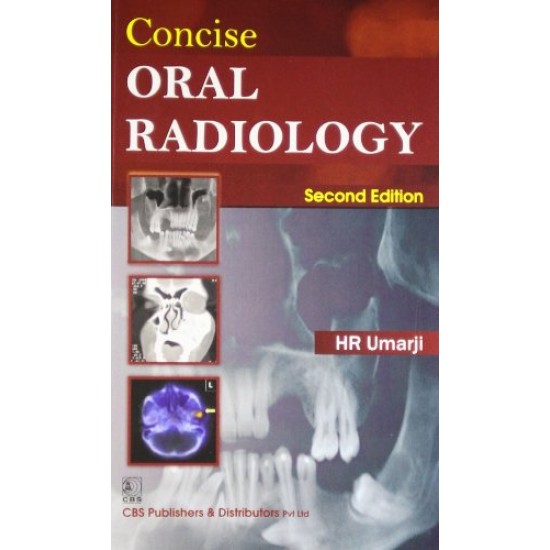 Concise Oral Radiology 2nd Edition by HR Umarji 