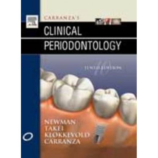 Carranza's Clinical Periodontology 10th Edition  by Fermin A. Carranza, Henry Takei, Michael G. Newman Perry R. Klokkevold 