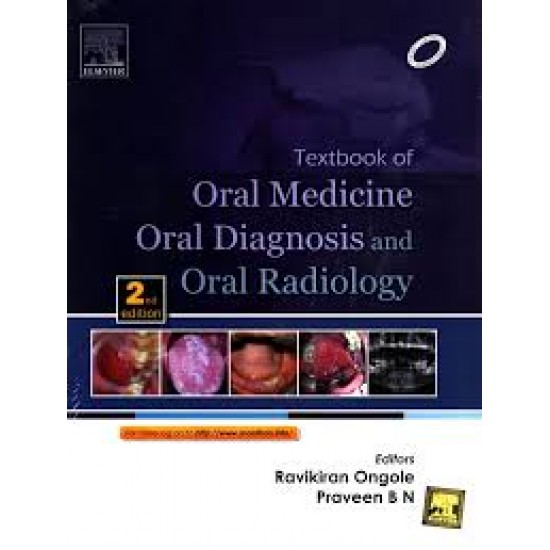 Textbook Of Oral Medicine Oral Diagnosis & Oral Radiology 2nd Edition by Ravikiran Ongole