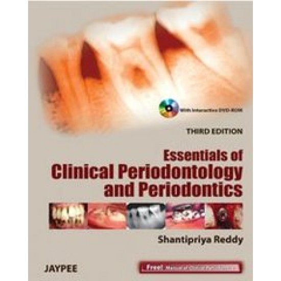 Essentials of Clinical Periodontology and Periodontics 3rd Edition by Shantipriya Reddy