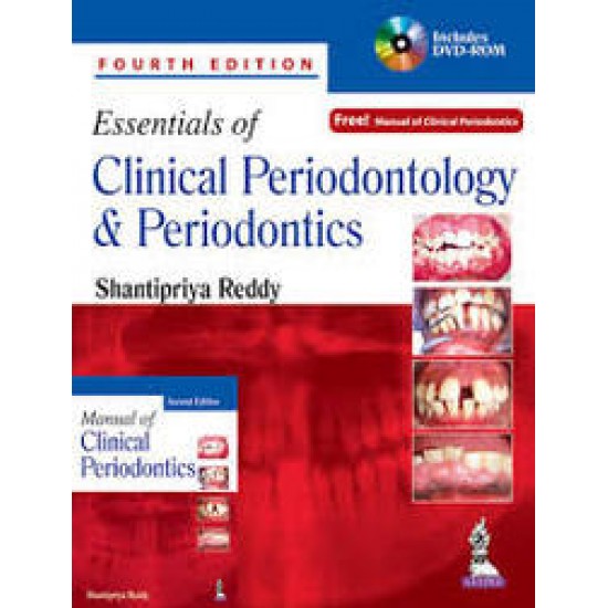 Essentials Of Clinical Periodontology & Periodontics 4th Edition by Shantipriya Reddy