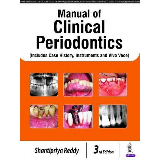 Manual of Clinical Periodontics 3rd Edition by Shantipriya Reddy 