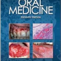 Burkets Oral Medicine 11th Edition by Martin Greenberg, Michael Glick, Jonathon Ship , B.C. Decker Inc