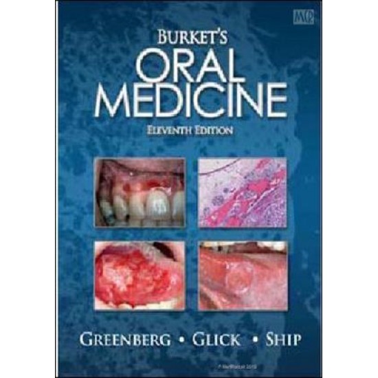 Burkets Oral Medicine 11th Edition by Martin Greenberg, Michael Glick, Jonathon Ship , B.C. Decker Inc