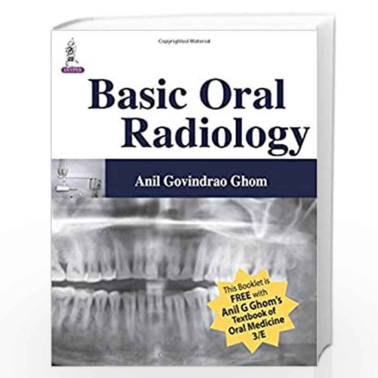 BASIC ORAL RADIOLOGY by Anil Govindrao Ghom