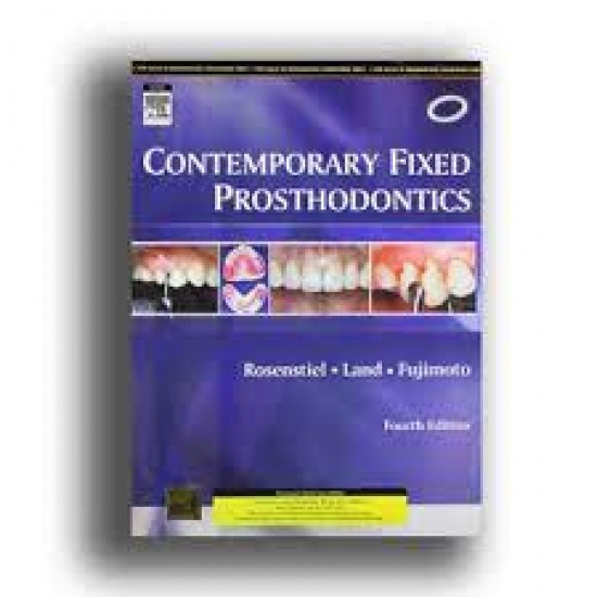 Contemporary Fixed Prosthodontics by Land Martin F