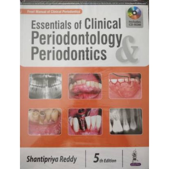 Essentials of Clinical Periodontology & Periodontics 5th edition by Reddy Shantipriya
