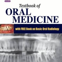 Textbook of Oral Medicine 3rd Edition by Ghom Anil Govindrao Textbook of Oral Medicine 3rd Edition by Ghom Anil Govindrao