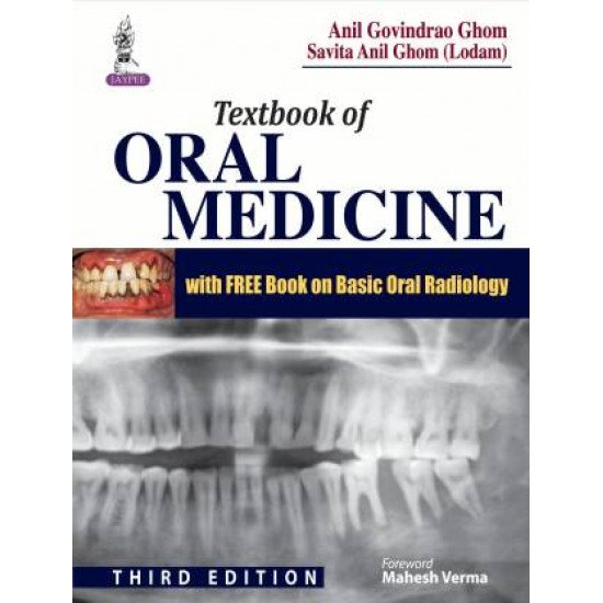 Textbook of Oral Medicine 3rd Edition by Ghom Anil Govindrao
