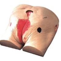 Decubitus Ulcer Care Model by Starter Group