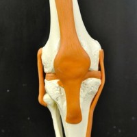 Knee Joint Model by Starter Group