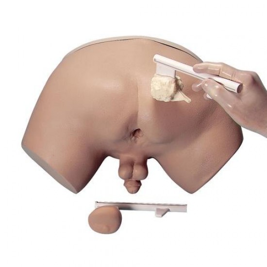 Prostate Inspection Model by Starter Group 