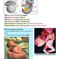 Anatomy Capsule Handwritten Notes 2020 by MED PG 