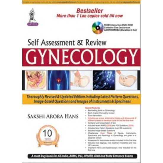 Self Assessment & Review of Gynaecology 10th Edition by Sakshi Arora Hans