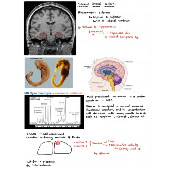 Radiology Colored Handwritten Notes by Dams 2020