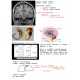 Radiology Colored Handwritten Notes by Dams 2020