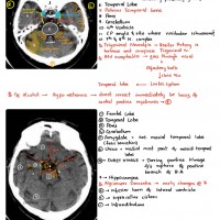 Radiology Colored Handwritten Notes by Dams 2020