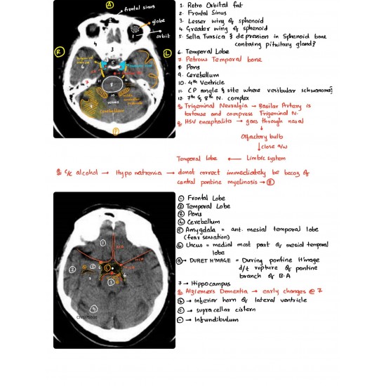 Radiology Colored Handwritten Notes by Dams 2020