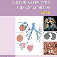 AN ATLAS OF CHRONIC OBSTRUCTIVE PULMONARY DISEASE (ENCYCLOPEDIA OF VISUAL MEDICINE SERIES) by Trevor T Hansel