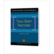 Complications in Orthopaedics: Tibial Shaft Fractures 1st Edition by William M. (Author, Editor), M.D. Ricci (Author, Editor)