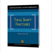 Complications in Orthopaedics: Tibial Shaft Fractures 1st Edition by William M. (Author, Editor), M.D. Ricci (Author, Editor)