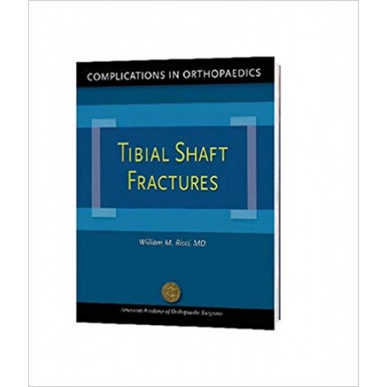 Complications in Orthopaedics: Tibial Shaft Fractures 1st Edition by William M. (Author, Editor), M.D. Ricci (Author, Editor)