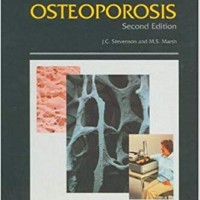 An Atlas of Osteoporosis, Second Edition (The Encyclopedia of Visual Medicine Series) (Englisch) Gebundenes Buch – 1. Januar 2000 von John C. Stevenson (Autor), Michael S. Marsh (Autor), M. S. Marsh (Autor)