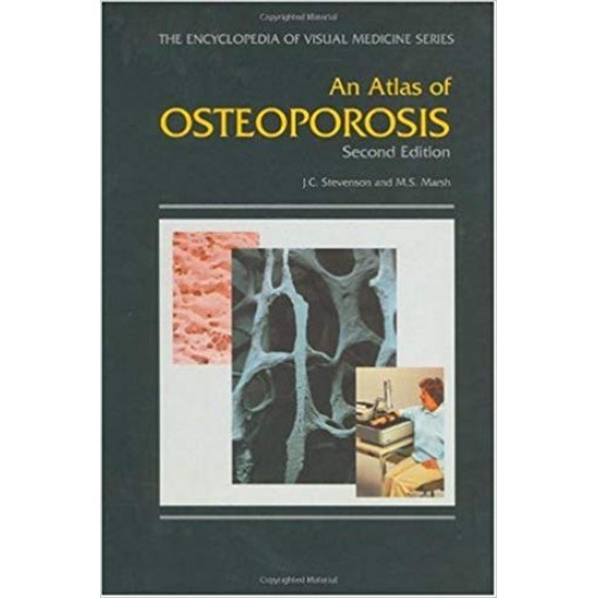 An Atlas of Osteoporosis, Second Edition (The Encyclopedia of Visual Medicine Series) (Englisch) Gebundenes Buch – 1. Januar 2000 von John C. Stevenson (Autor), Michael S. Marsh (Autor), M. S. Marsh (Autor)