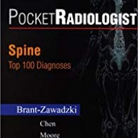 Pocket Radiologist Chest: Top 100 Diagnoses 1st Edition by Brat Zawadzki