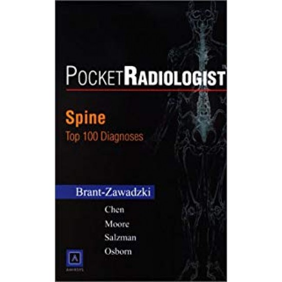 Pocket Radiologist Chest: Top 100 Diagnoses 1st Edition by Brat Zawadzki