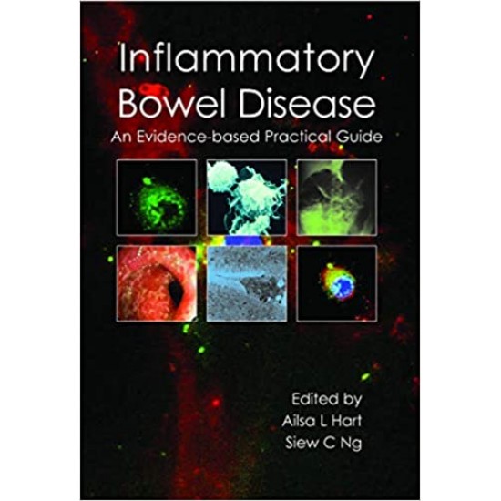 Inflammatory Bowel Disease: an Evidence-based Practical Guide 1st Edition by Dr Ailsa L Hart BMBCh MRCP PhD, Dr Siew C Ng MBBS MRCP PhD 