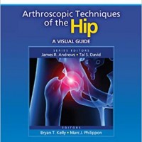 Arthroscopic Techniques of the Hip: A Visual Guide (Visual Arthroscopy) 1st Edition by Bryan T Kelly MD 