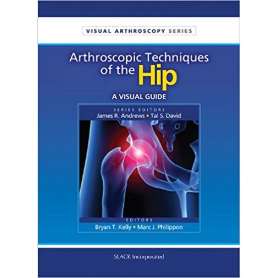 Arthroscopic Techniques of the Hip: A Visual Guide (Visual Arthroscopy) 1st Edition by Bryan T Kelly MD 