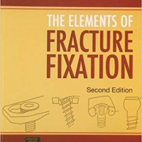 The Elements of Fracture Fixation Paperback by Thakur 