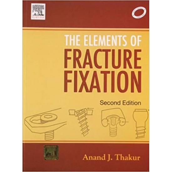 The Elements of Fracture Fixation Paperback by Thakur 