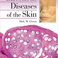 Infectious Diseases of the Skin  by Dirk M Elston  