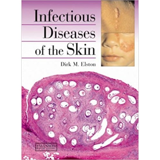 Infectious Diseases of the Skin  by Dirk M Elston  