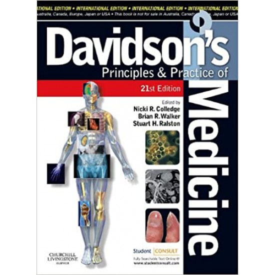 Davidson's Principles and Practice of Medicine Apparel 21st Edition by Nicki R. Colledge Stuart H. Ralston Brian R. Walker