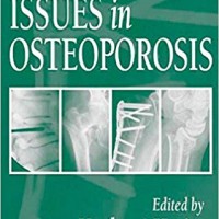 Orthopaedic Issues in Osteoporosis 1st Edition by Yuehuei H. An