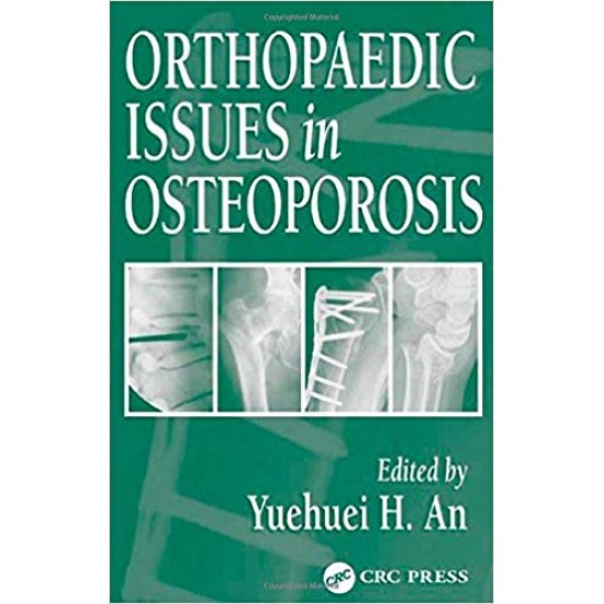 Orthopaedic Issues in Osteoporosis 1st Edition by Yuehuei H. An