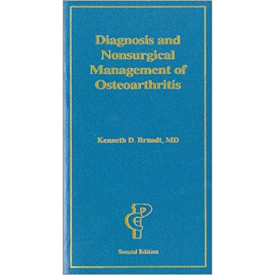 Diagnosis and Nonsurgical Management of Osteoarthritis Paperback – Import, Jun 2000 by Kenneth D. Brandt 
