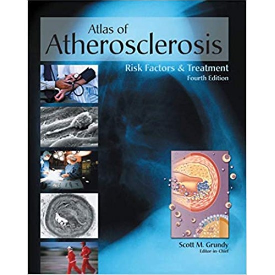 Atlas of Atherosclerosis and Metabolic Syndrome by Scott M. Grundy , Eugene Braunwald 