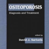 Osteoporosis: Diagnosis & Treatment by David J Sartoris