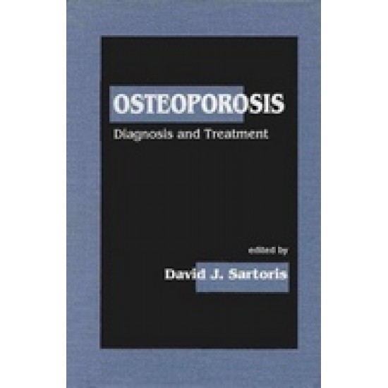 Osteoporosis: Diagnosis & Treatment by David J Sartoris